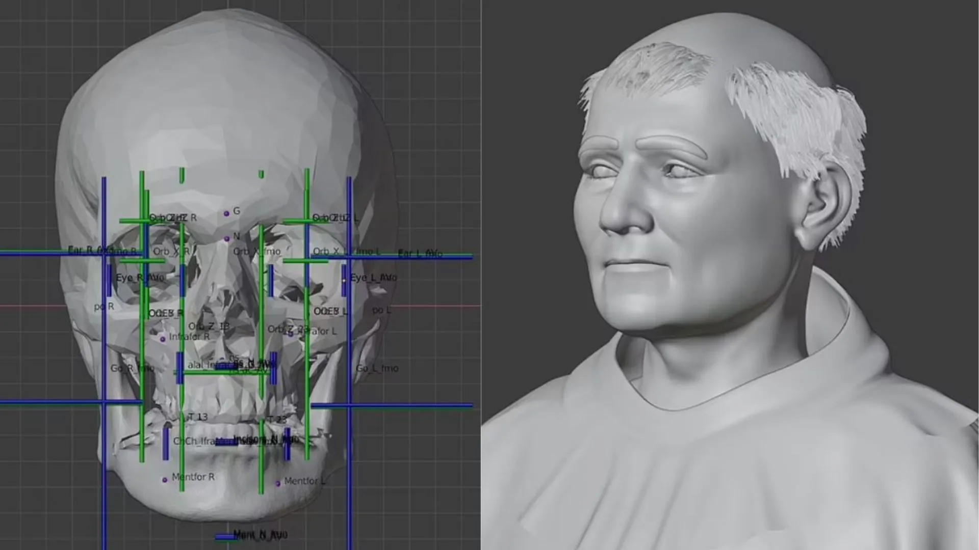Estudo revela como pode ter sido o rosto de São Tomás de Aquino