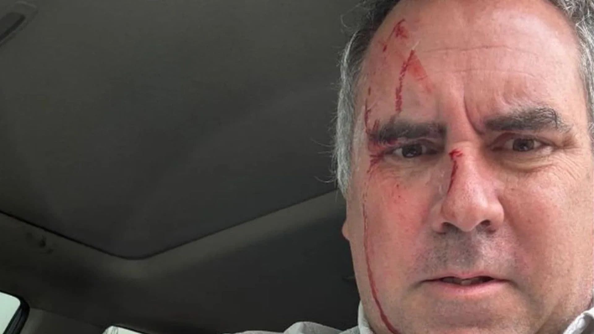 Pré-candidato à presidência do Peru que sofreu atentado.