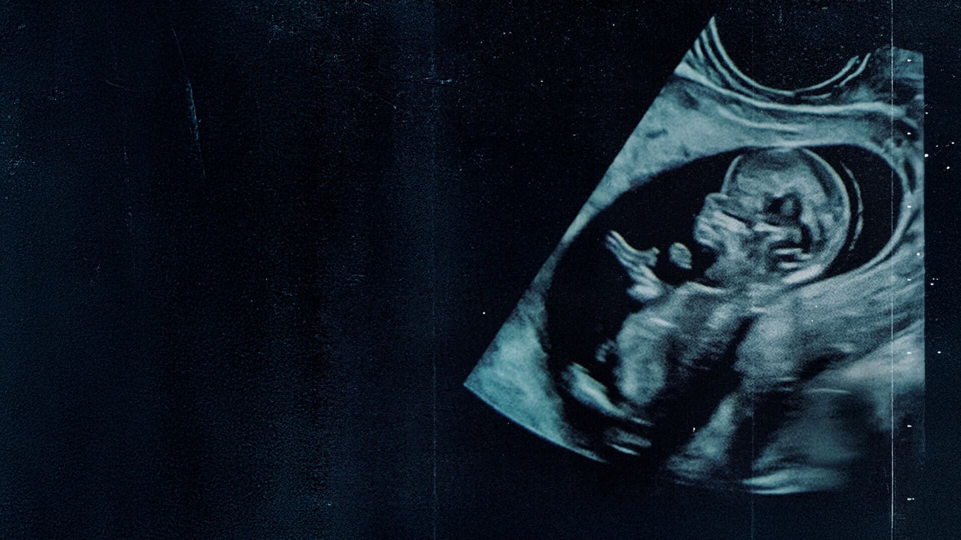 Duas vidas - Do que Estamos Falando quando Falamos de Aborto